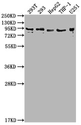 Western Blot
Positive WB detected in: 293T whole cell lysate, 293 whole cell lysate, HepG2 whole cell lysate, THP-1 whole cell lysate, U251 whole cell lysate
All lanes: CCHCR1 antibody at 1:2000
Secondary
Goat polyclonal to rabbit IgG at 1/50000 dilution
Predicted band size: 89, 100, 96 kDa
Observed band size: 89 kDa