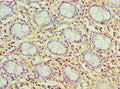 Immunohistochemistry of paraffin-embedded human colon&nbsp;tissue using CSB-PA004771ESR2HU at dilution of 1:100