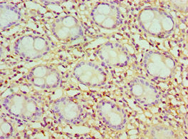 Immunohistochemistry of paraffin-embedded human colon&nbsp;tissue using CSB-PA004771ESR2HU at dilution of 1:100