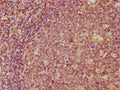 IHC image of CSB-PA004785DA01HU diluted at 1:300 and staining in paraffin-embedded human tonsil tissue performed on a Leica BondTM system. After dewaxing and hydration, antigen retrieval was mediated by high pressure in a citrate buffer (pH 6.0). Section was blocked with 10% normal goat serum 30min at RT. Then primary antibody (1% BSA) was incubated at 4&deg;C overnight. The primary is detected by a biotinylated secondary antibody and visualized using an HRP conjugated SP system.