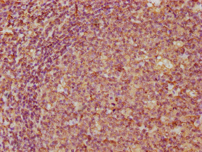 IHC image of CSB-PA004785DA01HU diluted at 1:300 and staining in paraffin-embedded human tonsil tissue performed on a Leica BondTM system. After dewaxing and hydration, antigen retrieval was mediated by high pressure in a citrate buffer (pH 6.0). Section was blocked with 10% normal goat serum 30min at RT. Then primary antibody (1% BSA) was incubated at 4&deg;C overnight. The primary is detected by a biotinylated secondary antibody and visualized using an HRP conjugated SP system.