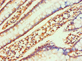 Immunohistochemistry of paraffin-embedded human small intestine tissue using CSB-PA004789ESR2HU at dilution of 1:100