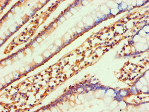 Immunohistochemistry of paraffin-embedded human small intestine tissue using CSB-PA004789ESR2HU at dilution of 1:100