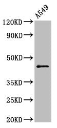Western Blot
Positive WB detected in: A549 whole cell lysate
All lanes: CCNB2 antibody at 2.5µg/ml
Secondary
Goat polyclonal to rabbit IgG at 1/50000 dilution
Predicted band size: 46 kDa
Observed band size: 46 kDa