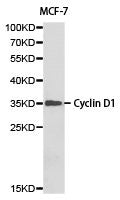 Western blot analysis of MCF-7 cell lysate ,using Cyclin D1 antibody.