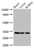Western Blot
Positive WB detected in: Mouse heart tissue, Mouse liver tissue, Mouse kidney tissue
All lanes: CCND2 antibody at 3.5ug/ml
Secondary
Goat polyclonal to rabbit IgG at 1/50000 dilution
Predicted band size: 34, 25 kDa
Observed band size: 34 kDa