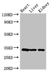 Western Blot
Positive WB detected in: Mouse heart tissue, Mouse liver tissue, Mouse kidney tissue
All lanes: CCND2 antibody at 3.5ug/ml
Secondary
Goat polyclonal to rabbit IgG at 1/50000 dilution
Predicted band size: 34, 25 kDa
Observed band size: 34 kDa