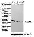Western Blot Positive WB detected in: K562 whole cell lysate(20µg), JK whole cell lysate(20µg), Raji whole cell lysate(20µg), Hela whole cell lysate(20µg), A549 whole cell lysate(20µg) All lanes:CCND3 antibody at 1:1000 Secondary Goat polyclonal to rabbit IgG at 1/20000 dilution Predicted band size: 33,23,25,10 kDa Observed band size: 33 kDa Exposure time: 120s