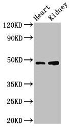 Western Blot
Positive WB detected in: Mouse heart tissue, Mouse kidney tissue
All lanes: CCNE1 antibody at 3.2ug/ml
Secondary
Goat polyclonal to rabbit IgG at 1/50000 dilution
Predicted band size: 48, 42, 46 kDa
Observed band size: 48 kDa