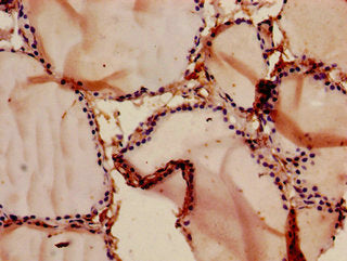 Immunohistochemistry of paraffin-embedded human thyroid tissue using CSB-PA004832LA01HU at dilution of 1:100