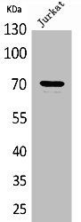 Western Blot analysis of Jurkat cells using Prothrombin Polyclonal Antibody