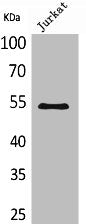 Western Blot analysis of Jurkat cells using MMP-12 Polyclonal Antibody