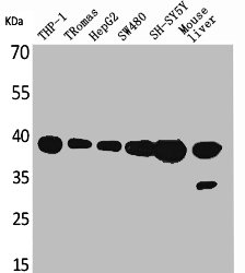 Western Blot analysis of THP-1 Romas HepG2 SW480 SHSY5Y Mouse liver cells using IL-10 Polyclonal Antibody