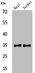 Western Blot analysis of Raji Jurkat cells using IL-4 Polyclonal Antibody