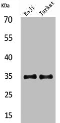 Western Blot analysis of Raji Jurkat cells using IL-4 Polyclonal Antibody