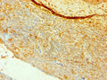Immunohistochemistry of paraffin-embedded human tonsil tissue using CSB-PA004935ESR2HU at dilution of 1:100