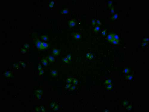 Immunofluorescence staining of A549 cells with CSB-PA004969LA11HU at 1:100, counter-stained with DAPI. The cells were blocked in 10% normal Goat Serum and incubated with the antibody overnight at 4°C. The secondary antibody was Alexa Fluor 488-congugated AffiniPure Goat Anti-Rabbit IgG(H+L).
