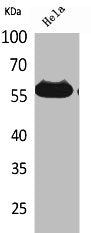 Western Blot analysis of HeLa cells using Amylase Polyclonal Antibody