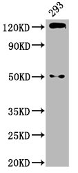 Western Blot
Positive WB detected in: 293 whole cell lysate
All lanes: CDH1 antibody at 2.9µg/ml
Secondary
Goat polyclonal to rabbit IgG at 1/50000 dilution
Predicted band size: 98, 91 kDa
Observed band size: 125 kDa