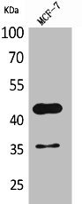 Western Blot analysis of MCF7 cells using Angptl4 Polyclonal Antibody