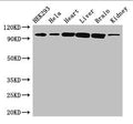 Western Blot
Positive WB detected in: HEK293 whole cell lysate, Hela whole cell lysate, Mouse heart tissue, Mouse liver tissue, Mouse brain tissue, Mouse kidney tissue
All lanes: CDH2 antibody at 3ug/ml
Secondary
Goat polyclonal to rabbit IgG at 1/50000 dilution
Predicted band size: 100, 98 kDa
Observed band size: 100 kDa
