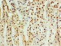 Immunohistochemistry of paraffin-embedded human adrenal gland tissue using CSB-PA005060ESR2HU at dilution of 1:100