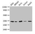 Western Blot
Positive WB detected in: K562 whole cell lysate, HEK293 whole cell lysate, Hela whole cell lysate, Jurkat whole cell lysate, HepG2 whole cell lysate
All lanes: CDK2 antibody at 2.6µg/ml
Secondary
Goat polyclonal to rabbit IgG at 1/50000 dilution
Predicted band size: 34, 31 kDa
Observed band size: 34 kDa