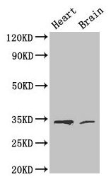 Western Blot
Positive WB detected in: Mouse heart tissue, Mouse brain tissue
All lanes: CDK5 antibody at 4µg/ml
Secondary
Goat polyclonal to rabbit IgG at 1/50000 dilution
Predicted band size: 34, 30 kDa
Observed band size: 34 kDa