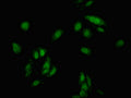 Immunofluorescent analysis of Hela cells using CSB-PA005088LA01HU at dilution of 1:100 and Alexa Fluor 488-congugated AffiniPure Goat Anti-Rabbit IgG(H+L)