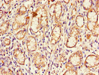 CDKN2B Antibody, FITC conjugated – Figure 1 of 3