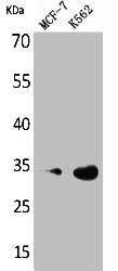Western Blot analysis of MCF7 K562 cells using Cdk4 Polyclonal Antibody