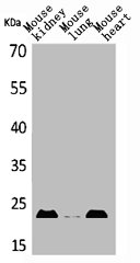 Western Blot analysis of mouse kidney mouse lung mouse heart cells using ADM Polyclonal Antibody