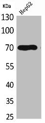 GPC3 Antibody – Figure 1 of 1