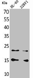 Western Blot analysis of HL-60 22RV-1 cells using MIP-1β Polyclonal Antibody