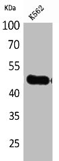 Western Blot analysis of K562 cells using IL-5Rα Polyclonal Antibody