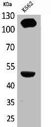 Western Blot analysis of K562 cells using Integrin α4 Polyclonal Antibody
