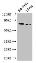 Western Blot
Positive WB detected in: SH-SY5Y whole cell lysate, Mouse liver tissue
All lanes: CHAT antibody at 3µg/ml
Secondary
Goat polyclonal to rabbit IgG at 1/50000 dilution
Predicted band size: 83, 75, 71 kDa
Observed band size: 75 kDa