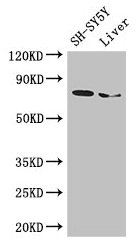 Western Blot
Positive WB detected in: SH-SY5Y whole cell lysate, Mouse liver tissue
All lanes: CHAT antibody at 3µg/ml
Secondary
Goat polyclonal to rabbit IgG at 1/50000 dilution
Predicted band size: 83, 75, 71 kDa
Observed band size: 75 kDa