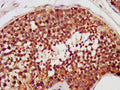 CHEK2 Antibody, FITC conjugated – Figure 1 of 1