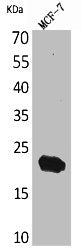 Western Blot analysis of MCF7 cells using IL-28 Polyclonal Antibody