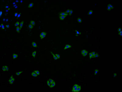 Immunofluorescence staining of HepG2 cells with CSB-PA005492LA01HU at 1:100, counter-stained with DAPI. The cells were fixed in 4% formaldehyde and blocked in 10% normal Goat Serum. The cells were then incubated with the antibody overnight at 4°C. The secondary antibody was Alexa Fluor 488-congugated AffiniPure Goat Anti-Rabbit IgG(H+L).