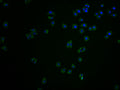 Immunofluorescence staining of HepG2 cells with CSB-PA005492LA11HU at 1:100, counter-stained with DAPI. The cells were fixed in 4% formaldehyde and blocked in 10% normal Goat Serum. The cells were then incubated with the antibody overnight at 4°C. The secondary antibody was Alexa Fluor 488-congugated AffiniPure Goat Anti-Rabbit IgG(H+L).