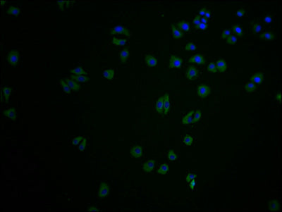Immunofluorescence staining of HepG2 cells with CSB-PA005492LA11HU at 1:100, counter-stained with DAPI. The cells were fixed in 4% formaldehyde and blocked in 10% normal Goat Serum. The cells were then incubated with the antibody overnight at 4°C. The secondary antibody was Alexa Fluor 488-congugated AffiniPure Goat Anti-Rabbit IgG(H+L).