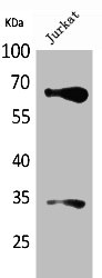 Western Blot analysis of Jurkat cells using Nrf2 Polyclonal Antibody