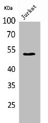 Western Blot analysis of Jurkat cells using Tubulin α Polyclonal Antibody