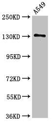 Western Blot
Positive WB detected in: A549 whole cell lysate
All lanes: EGFR antibody at 2.5ug/ml
Secondary
Goat polyclonal to rabbit IgG at 1/50000 dilution
Predicted band size: 135, 45, 78, 70 kDa
Observed band size: 135 kDa