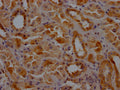 IHC image of CSB-PA005593LA01HU diluted at 1:200 and staining in paraffin-embedded human kidney tissue performed on a Leica BondTM system. After dewaxing and hydration, antigen retrieval was mediated by high pressure in a citrate buffer (pH 6.0). Section was blocked with 10% normal goat serum 30min at RT. Then primary antibody (1% BSA) was incubated at 4°C overnight. The primary is detected by a Goat anti-rabbit polymer IgG labeled by HRP and visualized using 0.05% DAB.
