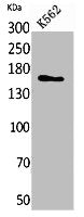 Western Blot analysis of K562 cells using Laminin γ-2 Polyclonal Antibody.