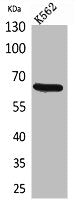 Western Blot analysis of K562 cells using CD166 Polyclonal Antibody.