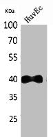 Western Blot analysis of HuvEc cells using IL-8Rβ Polyclonal Antibody.
